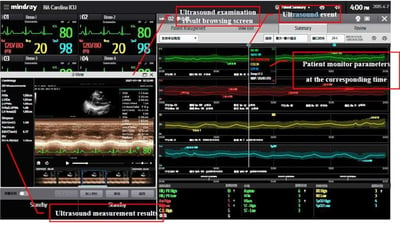 24.07 DXI - Blog POC 2