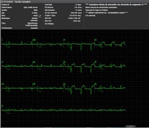 Benevision - visualización de informes