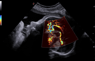 Blog DXI prenatal2.jpg