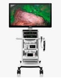 Laparoscopia 3D 4