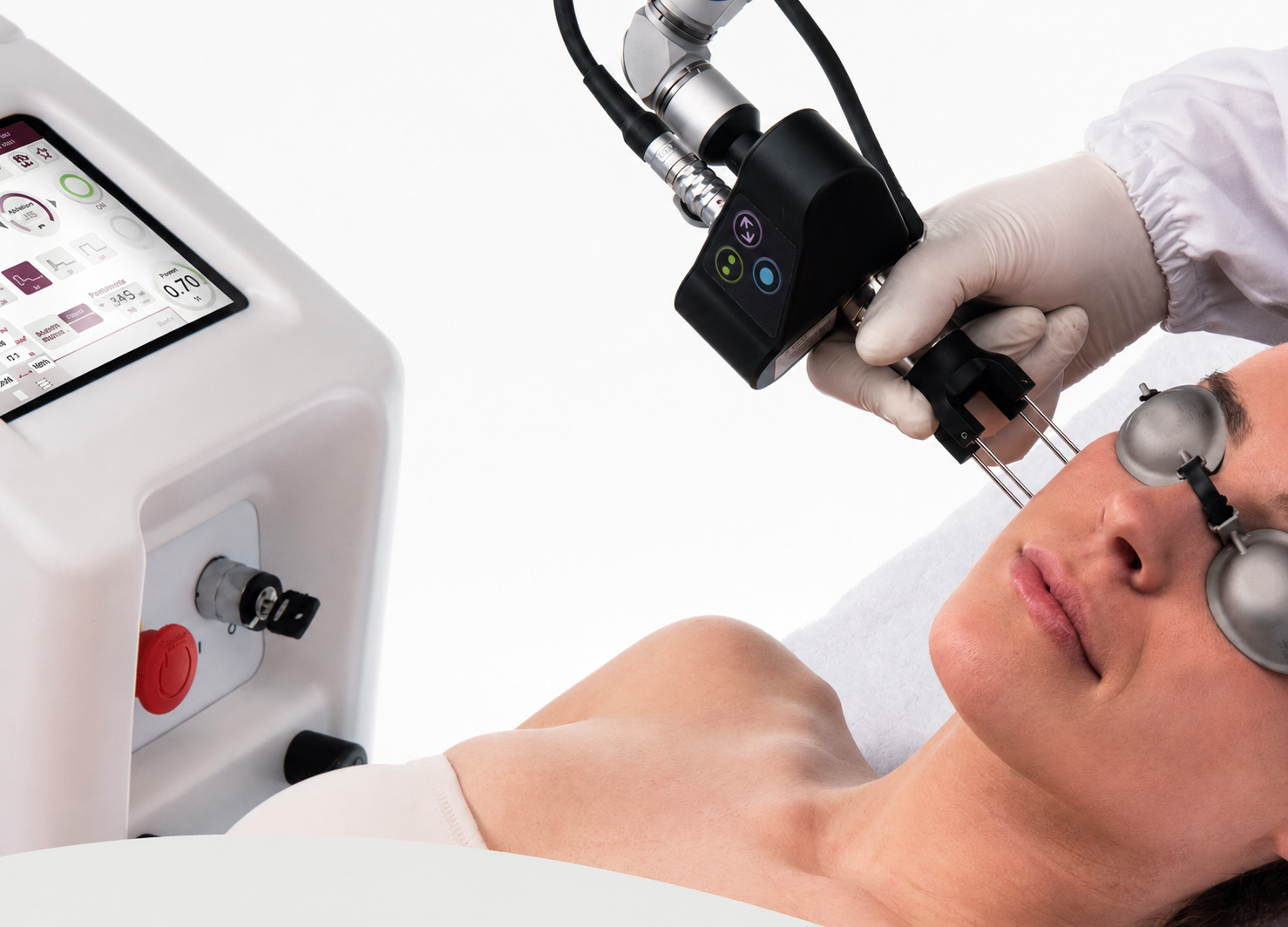 Tratamiento facial con láser CO₂ fraccionado utilizando aplicador DEKA sobre la piel.