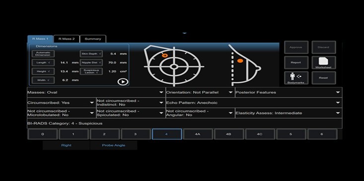 diagnóstico mamario