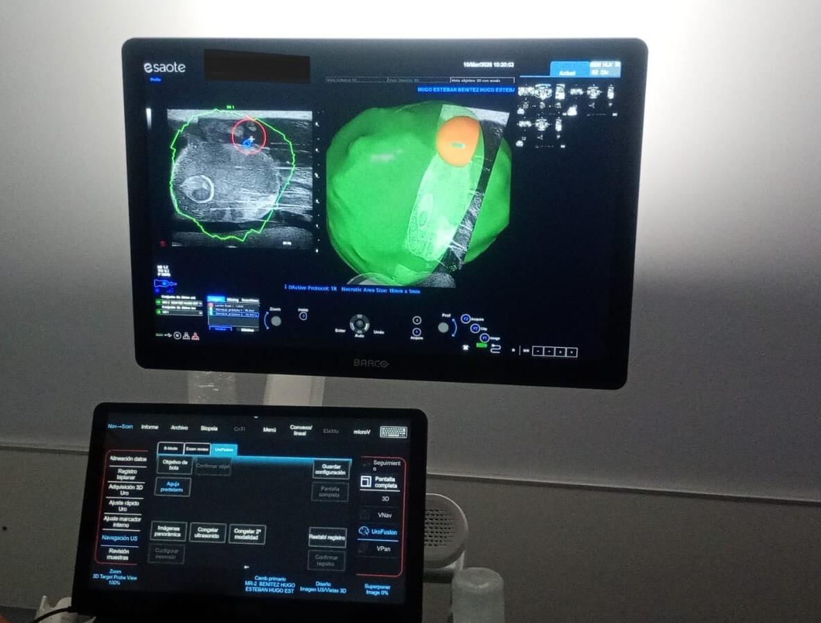 urofusion