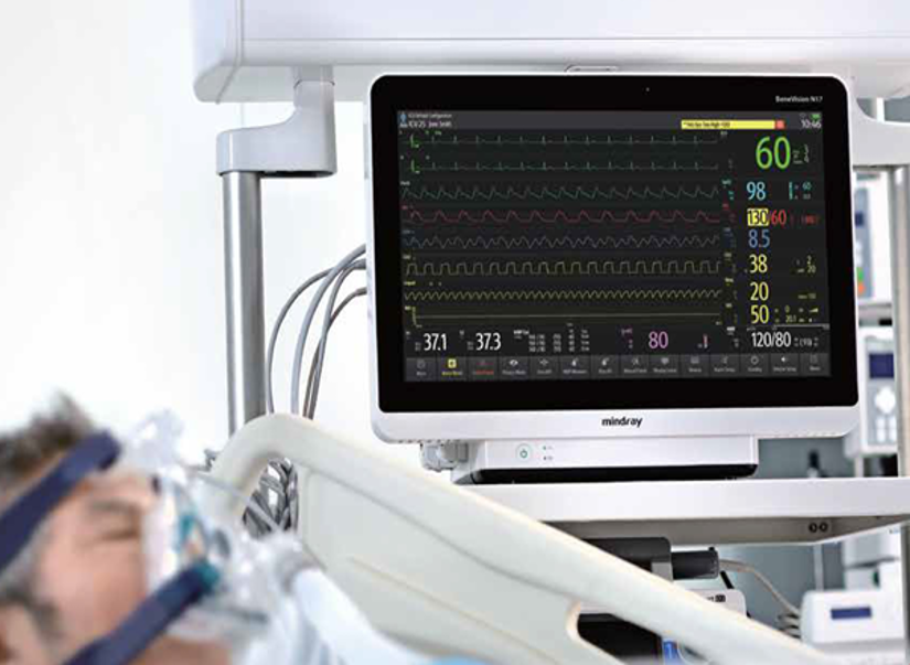 Monitorización del gasto cardiaco - benevision serie n