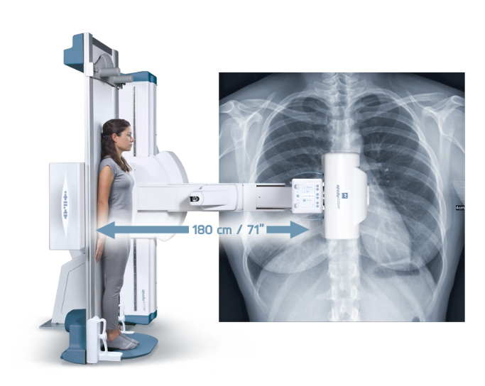 fluoroscopia seriógrafo