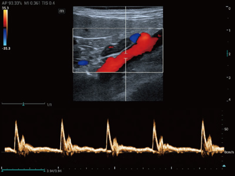 aorta abdominal canina