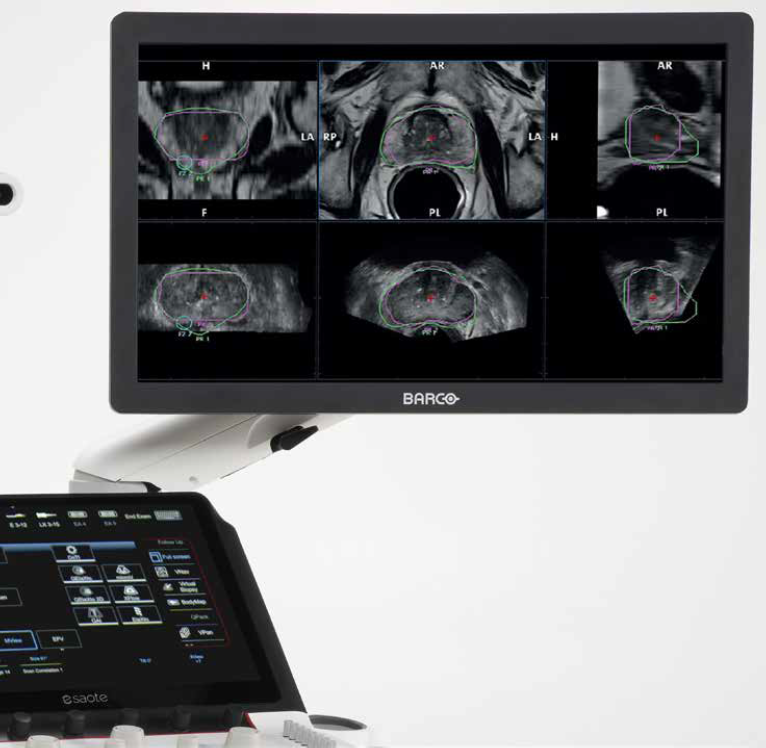 urofusion
